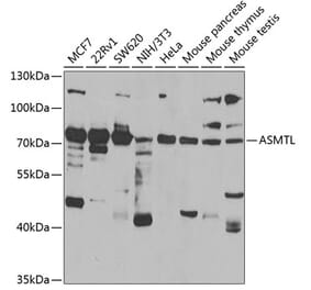 Western Blot - Anti-ASMTL Antibody (A15491) - Antibodies.com