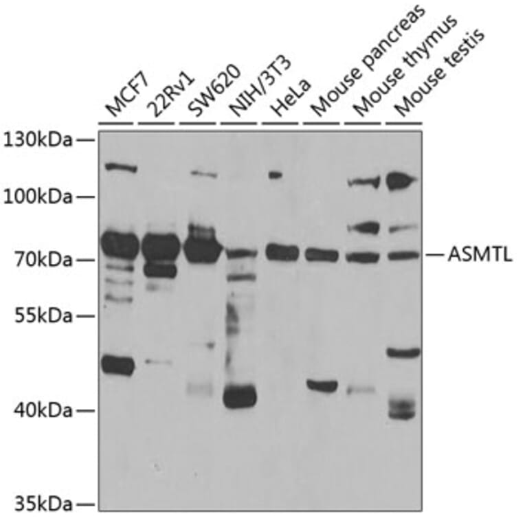 Western Blot - Anti-ASMTL Antibody (A15491) - Antibodies.com