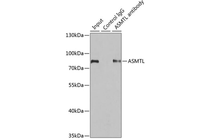 Western Blot - Anti-ASMTL Antibody (A15491) - Antibodies.com