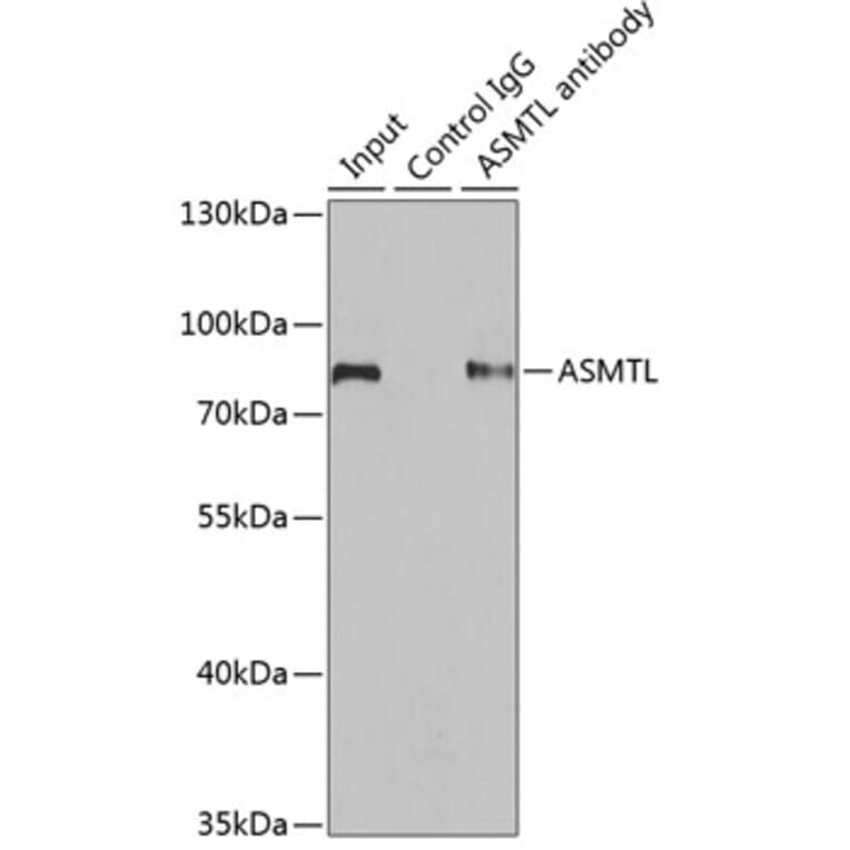 Western Blot - Anti-ASMTL Antibody (A15491) - Antibodies.com