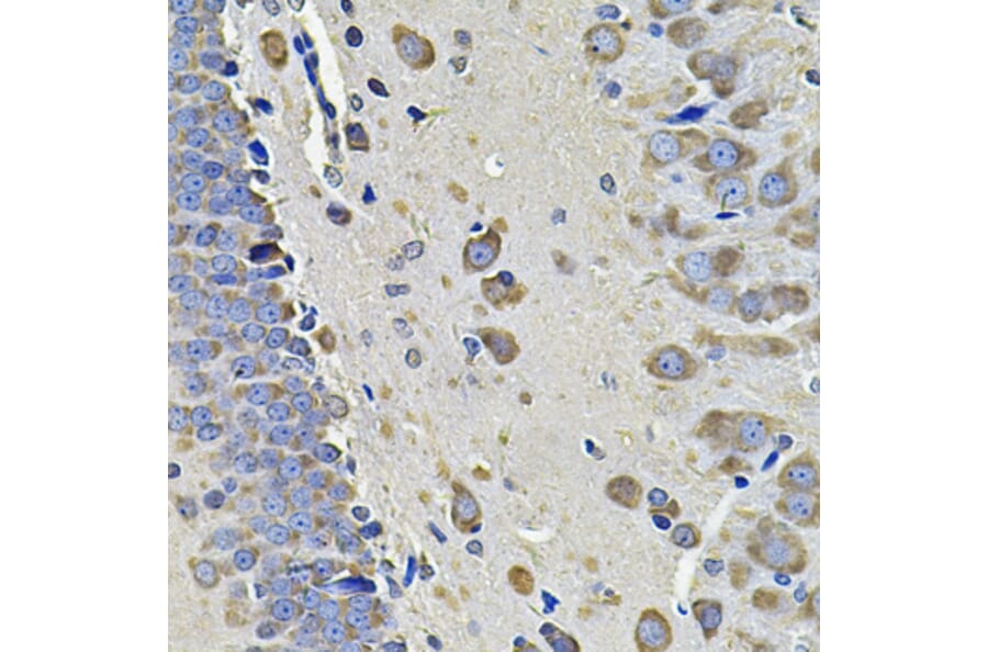 Immunohistochemistry - Anti-EIF3C Antibody (A15492) - Antibodies.com