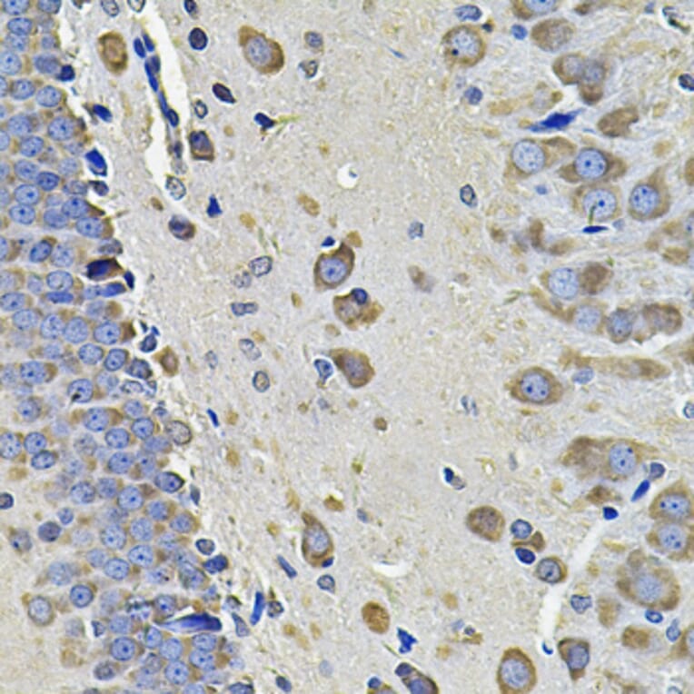 Immunohistochemistry - Anti-EIF3C Antibody (A15492) - Antibodies.com