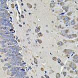 Immunohistochemistry - Anti-EIF3C Antibody (A15492) - Antibodies.com