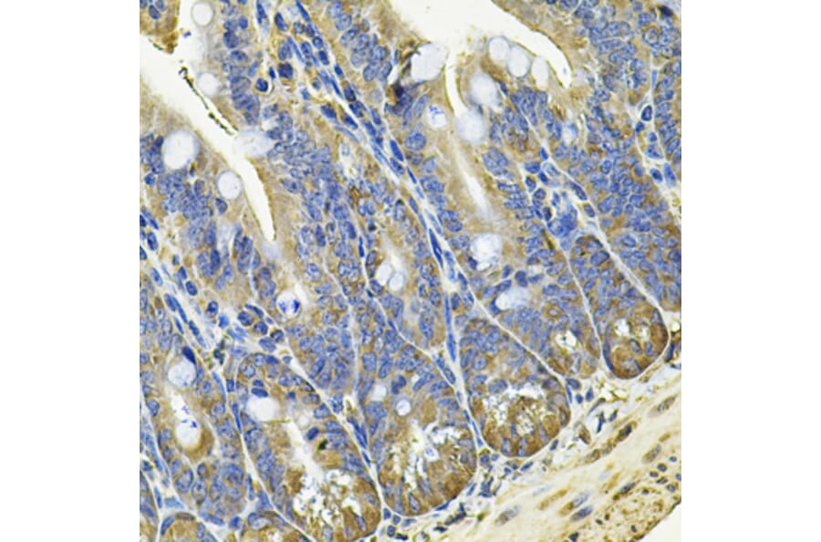 Immunohistochemistry - Anti-EIF3C Antibody (A15492) - Antibodies.com