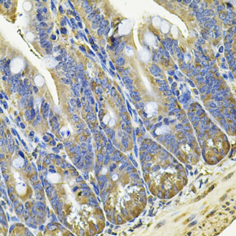 Immunohistochemistry - Anti-EIF3C Antibody (A15492) - Antibodies.com