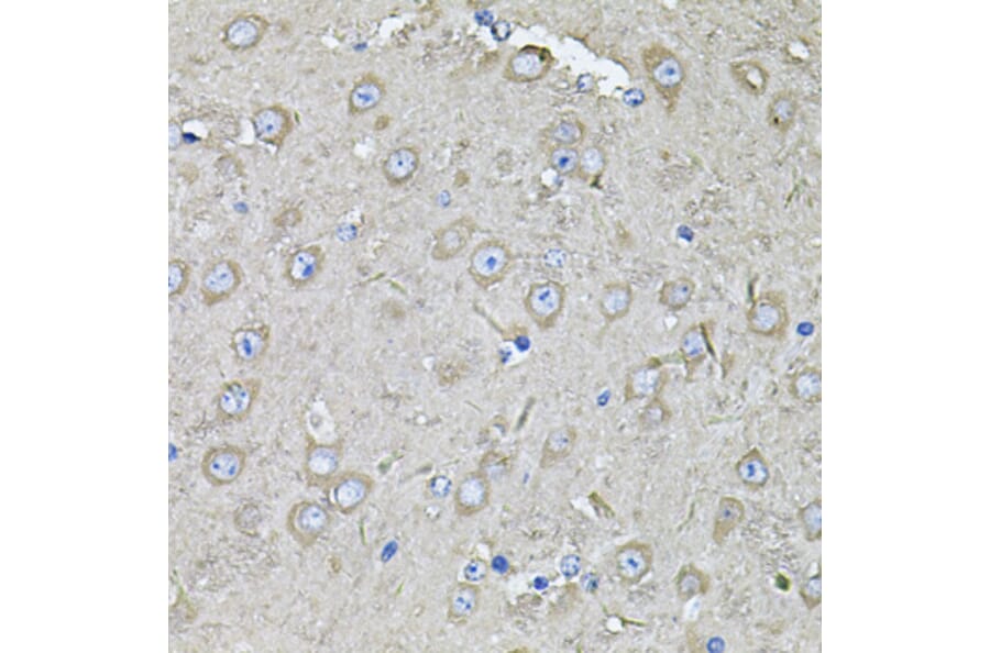 Immunohistochemistry - Anti-EIF3C Antibody (A15492) - Antibodies.com