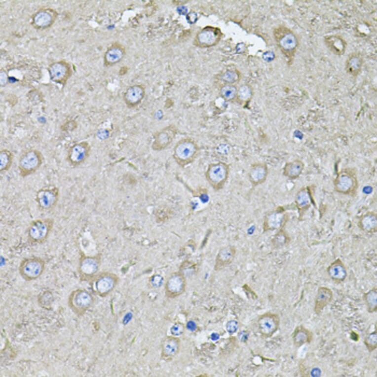 Immunohistochemistry - Anti-EIF3C Antibody (A15492) - Antibodies.com