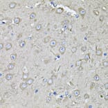 Immunohistochemistry - Anti-EIF3C Antibody (A15492) - Antibodies.com