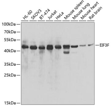 Western blot analysis of extracts of various cell lines, using Anti-EIF3F Antibody (A7023) at 1:1,000 dilution.
Secondary antibody: Goat Anti-Rabbit IgG (H+L) (HRP) (AS014) at 1:10,000 dilution.
Lysates / proteins: 25µg per lane.
Blocking buffer: 3% non-fat dry milk in TBST.
Detection: ECL Basic Kit (RM00020).
Exposure time: 10s.