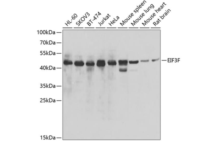 Western Blot - Anti-EIF3F Antibody (A15493) - Antibodies.com