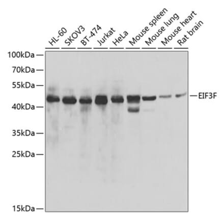 Western Blot - Anti-EIF3F Antibody (A15493) - Antibodies.com