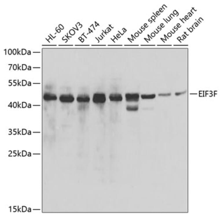 Western Blot - Anti-EIF3F Antibody (A15493) - Antibodies.com