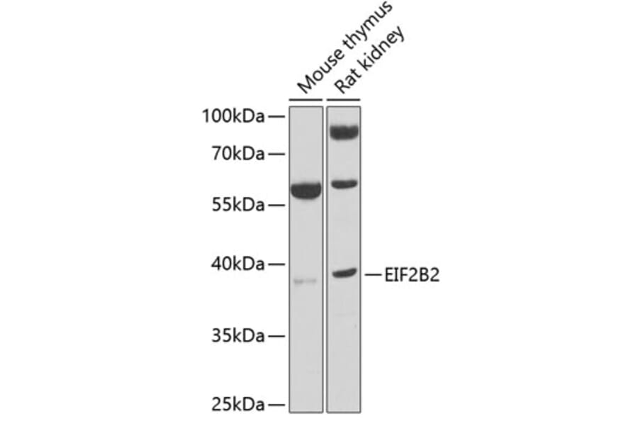 Western Blot - Anti-EIF2B2 Antibody (A15496) - Antibodies.com