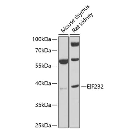 Western Blot - Anti-EIF2B2 Antibody (A15496) - Antibodies.com