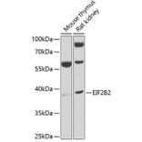 Western Blot - Anti-EIF2B2 Antibody (A15496) - Antibodies.com