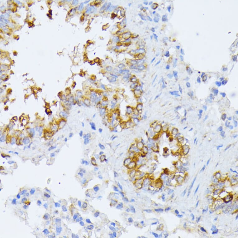 Immunohistochemistry - Anti-EIF2B2 Antibody (A15496) - Antibodies.com