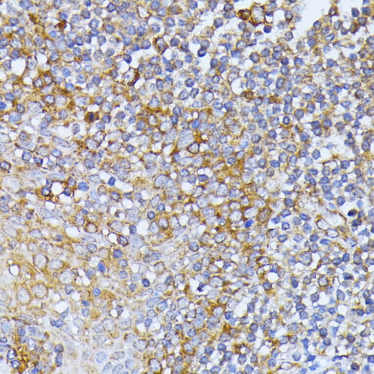 Immunohistochemistry - Anti-EIF2B2 Antibody (A15496) - Antibodies.com