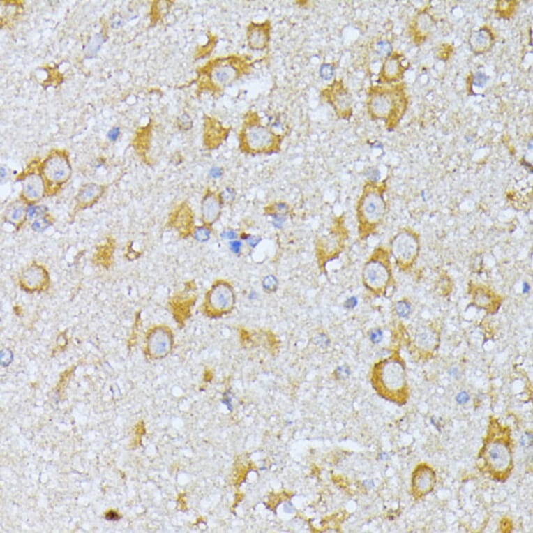 Immunohistochemistry - Anti-EIF2B2 Antibody (A15496) - Antibodies.com