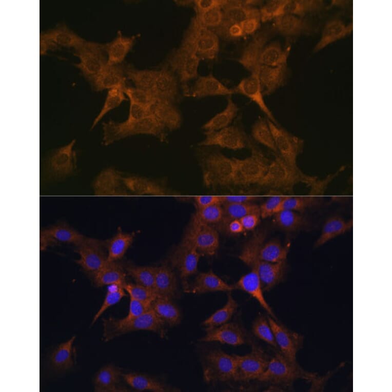 Immunofluorescence - Anti-EIF2B2 Antibody (A15496) - Antibodies.com