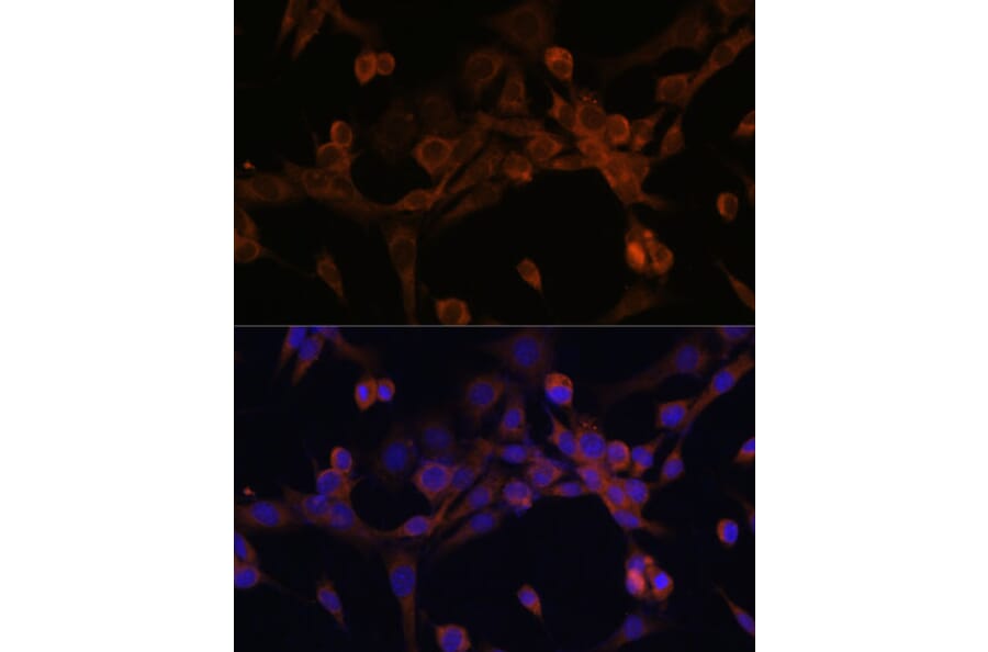 Immunofluorescence - Anti-EIF2B2 Antibody (A15496) - Antibodies.com