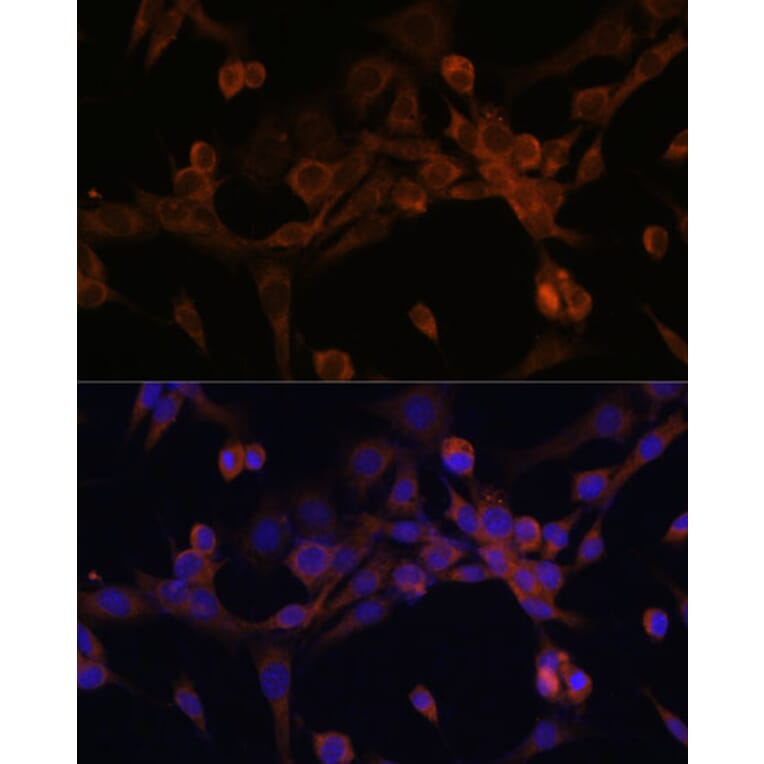 Immunofluorescence - Anti-EIF2B2 Antibody (A15496) - Antibodies.com