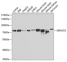 Western Blot - Anti-MTGR1 Antibody (A15499) - Antibodies.com