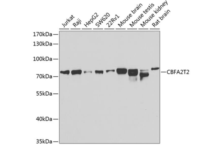 Western Blot - Anti-MTGR1 Antibody (A15499) - Antibodies.com