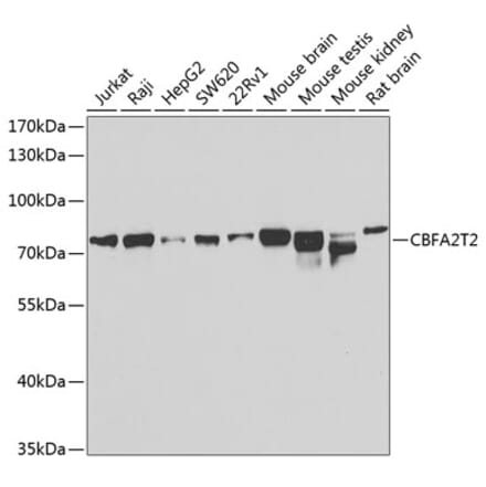 Western Blot - Anti-MTGR1 Antibody (A15499) - Antibodies.com