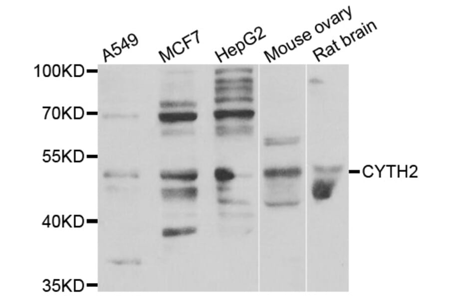 Western Blot - Anti-CYTH2 Antibody (A7035) - Antibodies.com