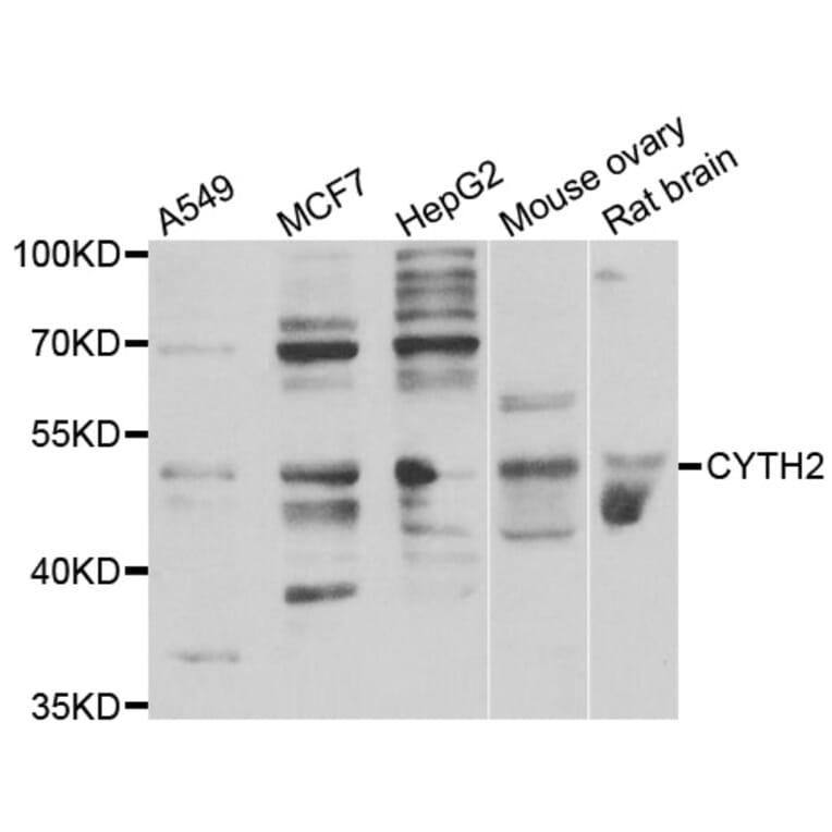 Western Blot - Anti-CYTH2 Antibody (A7035) - Antibodies.com