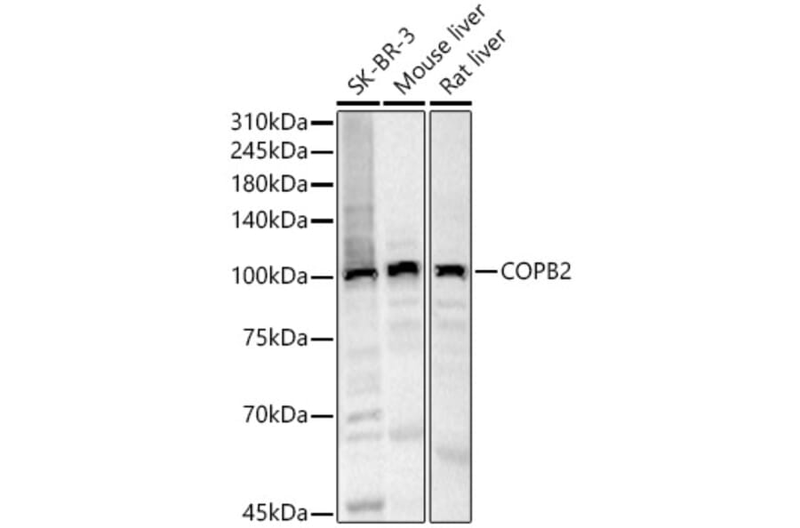 Western Blot - Anti-COPB2 Antibody (A15501) - Antibodies.com