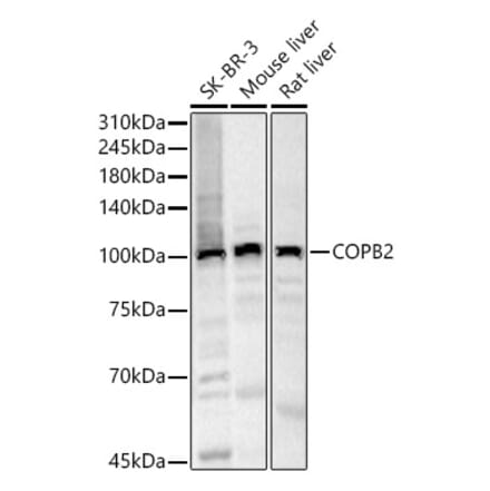 Western Blot - Anti-COPB2 Antibody (A15501) - Antibodies.com