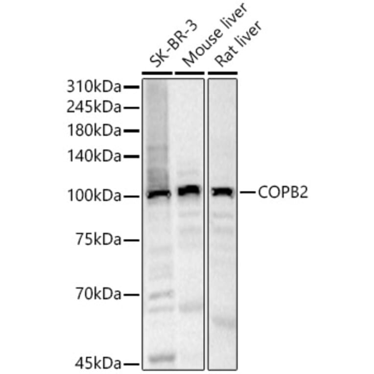 Western Blot - Anti-COPB2 Antibody (A15501) - Antibodies.com