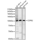 Western Blot - Anti-COPB2 Antibody (A15501) - Antibodies.com