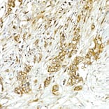 Immunohistochemistry - Anti-COPB2 Antibody (A15501) - Antibodies.com