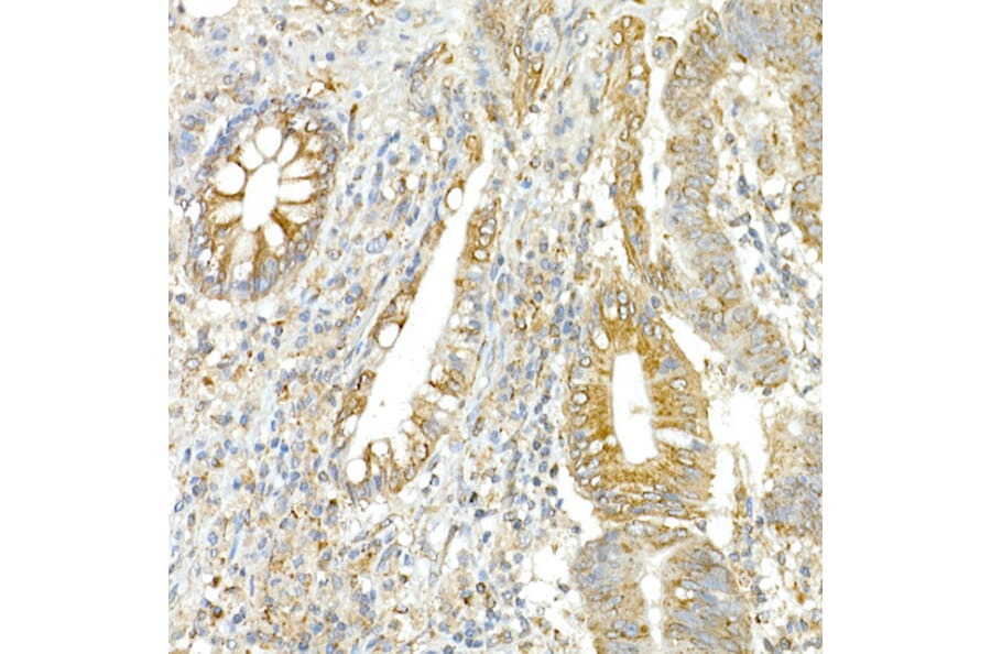 Immunohistochemistry - Anti-COPB2 Antibody (A15501) - Antibodies.com