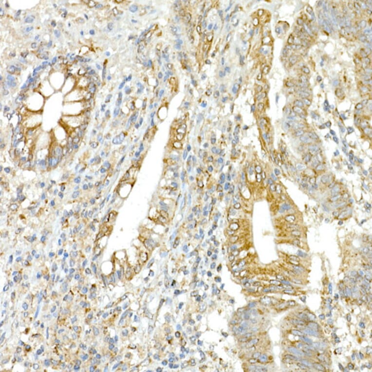 Immunohistochemistry - Anti-COPB2 Antibody (A15501) - Antibodies.com