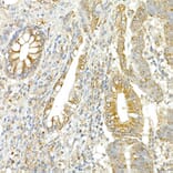 Immunohistochemistry - Anti-COPB2 Antibody (A15501) - Antibodies.com