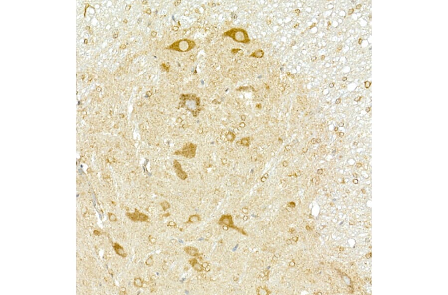 Immunohistochemistry - Anti-COPB2 Antibody (A15501) - Antibodies.com