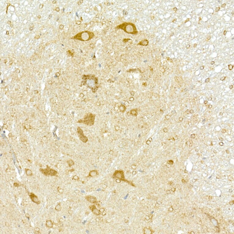 Immunohistochemistry - Anti-COPB2 Antibody (A15501) - Antibodies.com