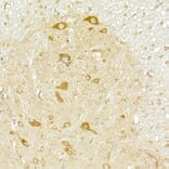 Immunohistochemistry - Anti-COPB2 Antibody (A15501) - Antibodies.com