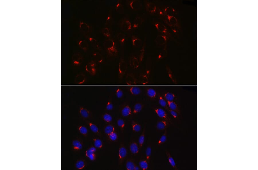 Immunofluorescence - Anti-COPB2 Antibody (A15501) - Antibodies.com