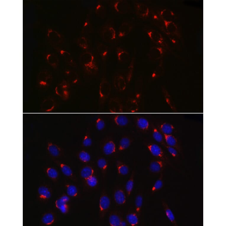 Immunofluorescence - Anti-COPB2 Antibody (A15501) - Antibodies.com