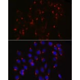 Immunofluorescence - Anti-COPB2 Antibody (A15501) - Antibodies.com