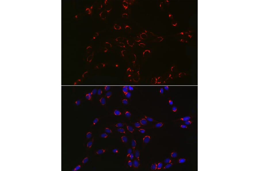 Immunofluorescence - Anti-COPB2 Antibody (A15501) - Antibodies.com