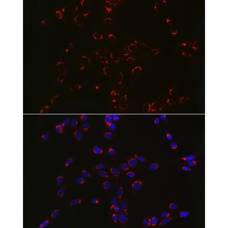 Immunofluorescence - Anti-COPB2 Antibody (A15501) - Antibodies.com