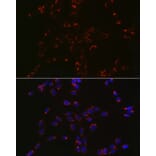 Immunofluorescence - Anti-COPB2 Antibody (A15501) - Antibodies.com