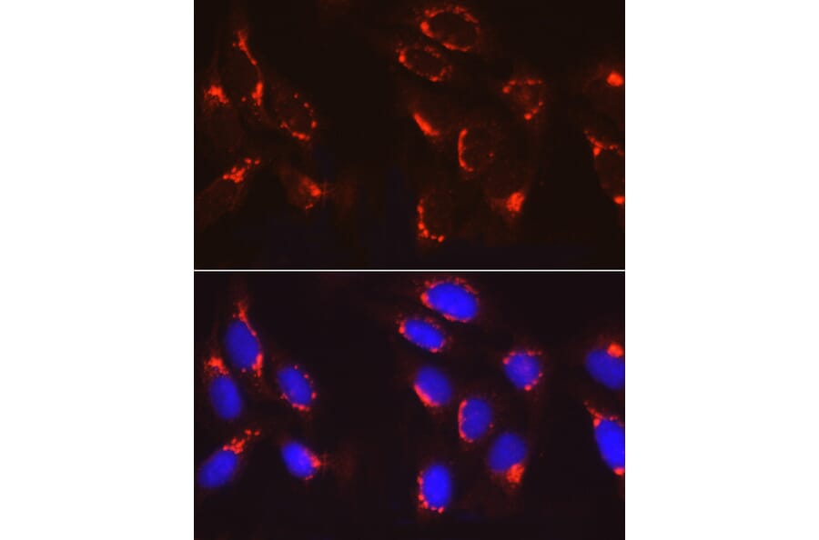 Immunofluorescence - Anti-COPB2 Antibody (A15501) - Antibodies.com