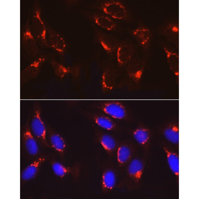 Immunofluorescence - Anti-COPB2 Antibody (A15501) - Antibodies.com
