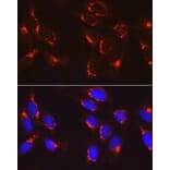 Immunofluorescence - Anti-COPB2 Antibody (A15501) - Antibodies.com